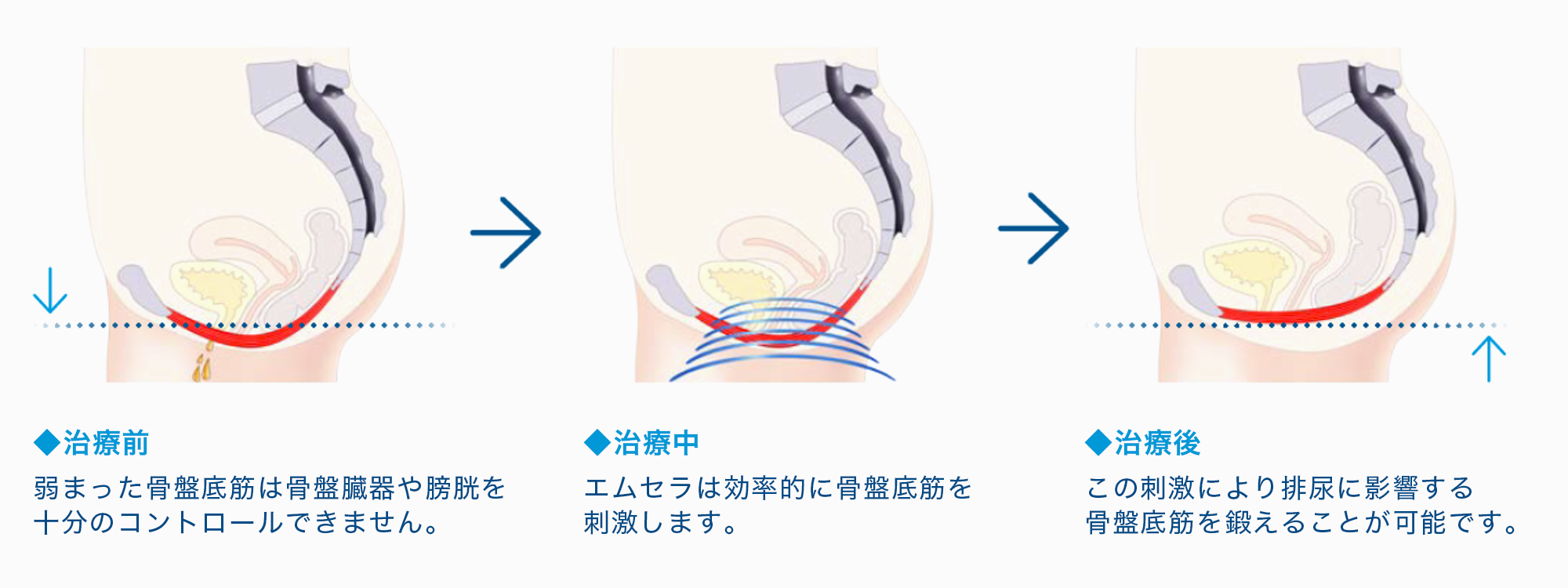 原理